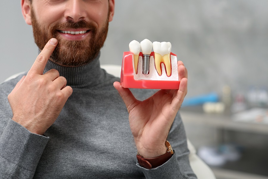 How Many Dental Implants Are Needed For A Full Mouth Dental Implant Procedure?