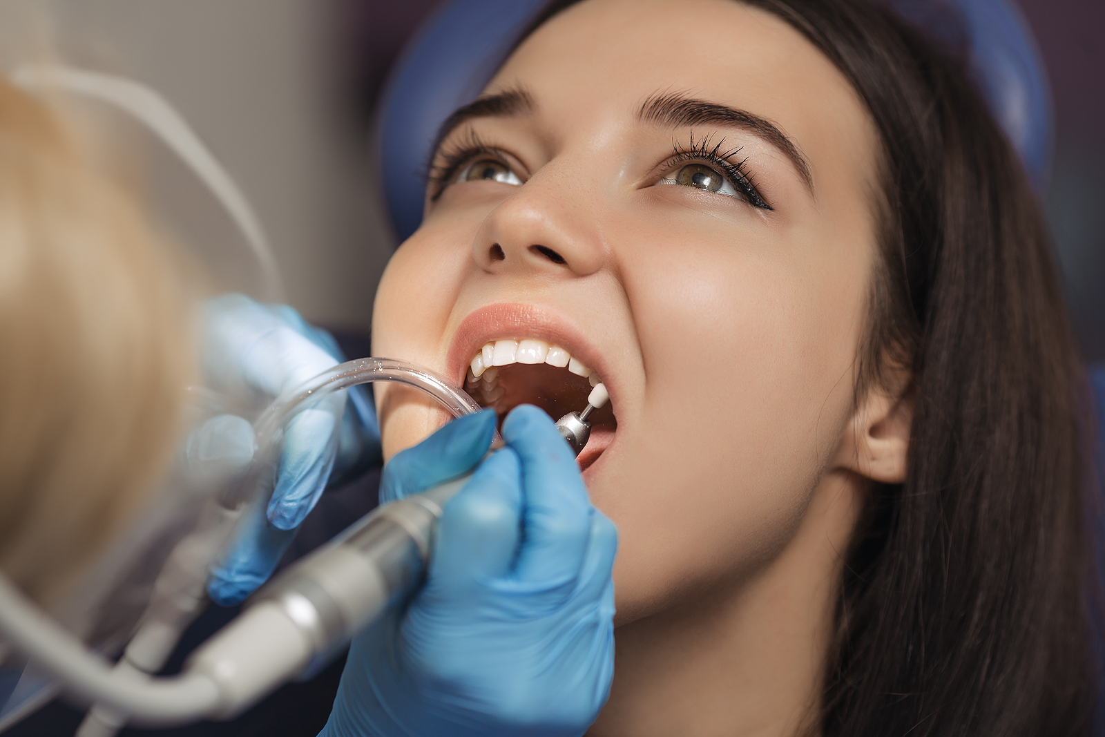Essential Aftercare Tips for a Speedy Recovery After Tooth Extraction